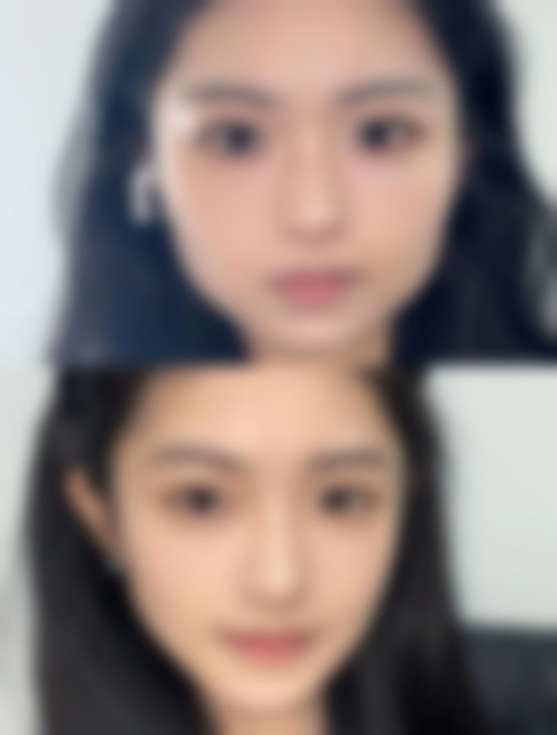 大连熙朵植发口碑如何?