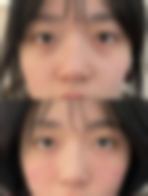 总结——郑州明灿整形美容医院怎么样?