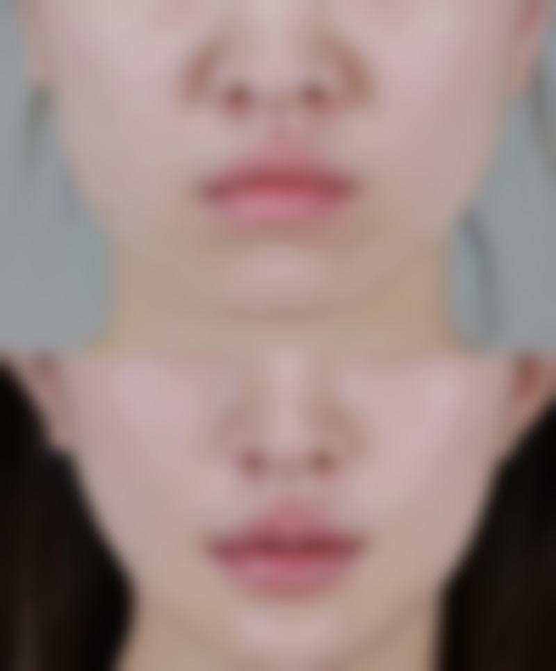 真实实例对比:不同护理方式的不同结果