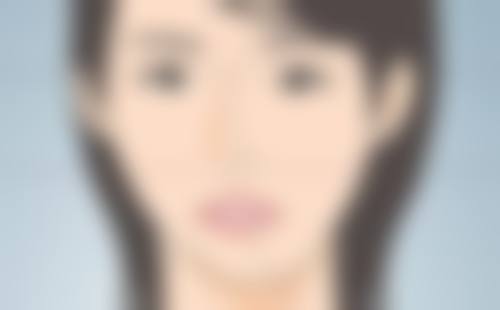 少女针隆鼻可以维持多久？一般1 - 2年，受体质、剂量、护理等因素影响