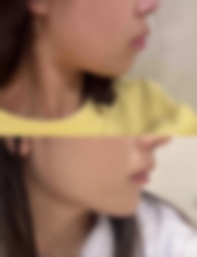 总结——太原芮思米医疗美容怎么样？