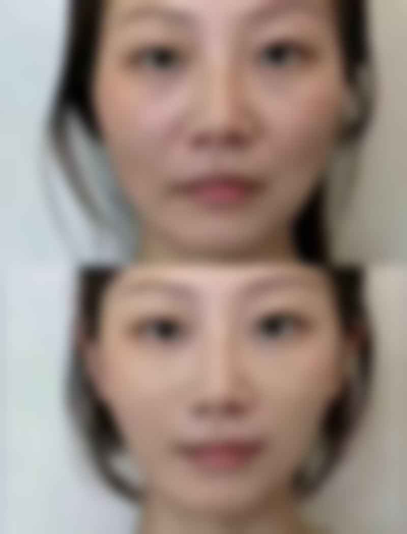 按摩小技巧：长期坚持或有惊喜