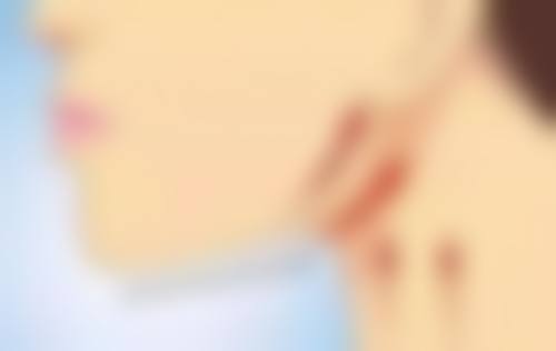 自然衰老让33岁出现眼袋
