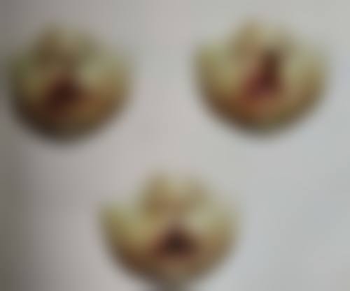 阴道紧缩术成效消失后怎么办