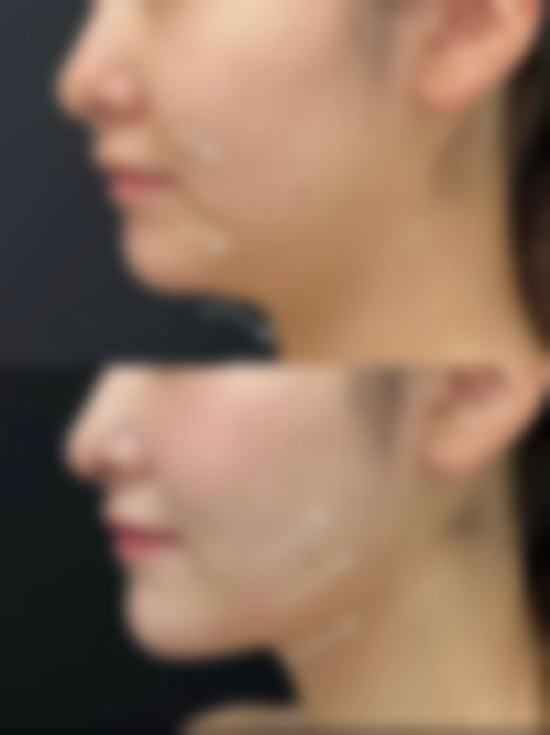 陕西汉中璞奢佰斯汀整形医院地址