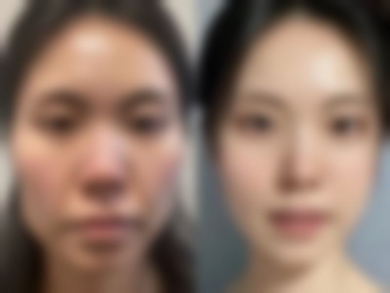 重庆原辰整形美容医院口碑如何?