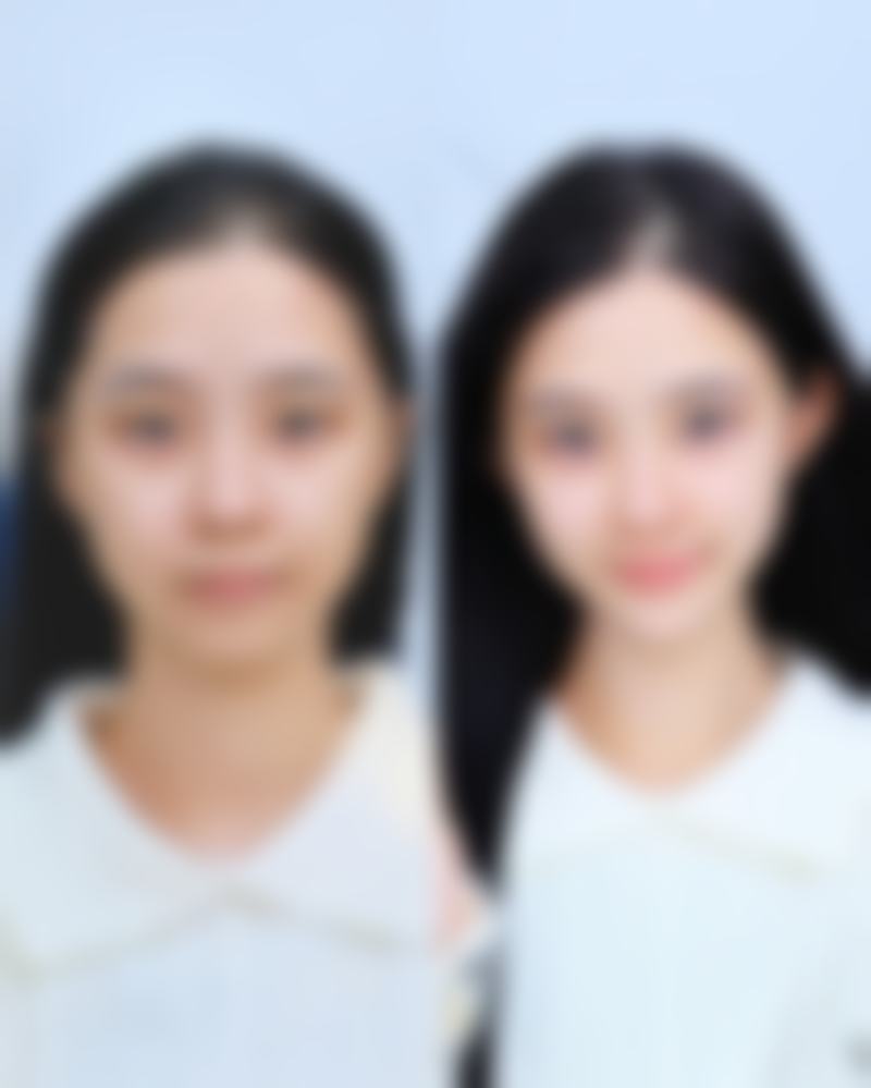 总结——西安先雁塔柏凯医疗美容医院怎么样?