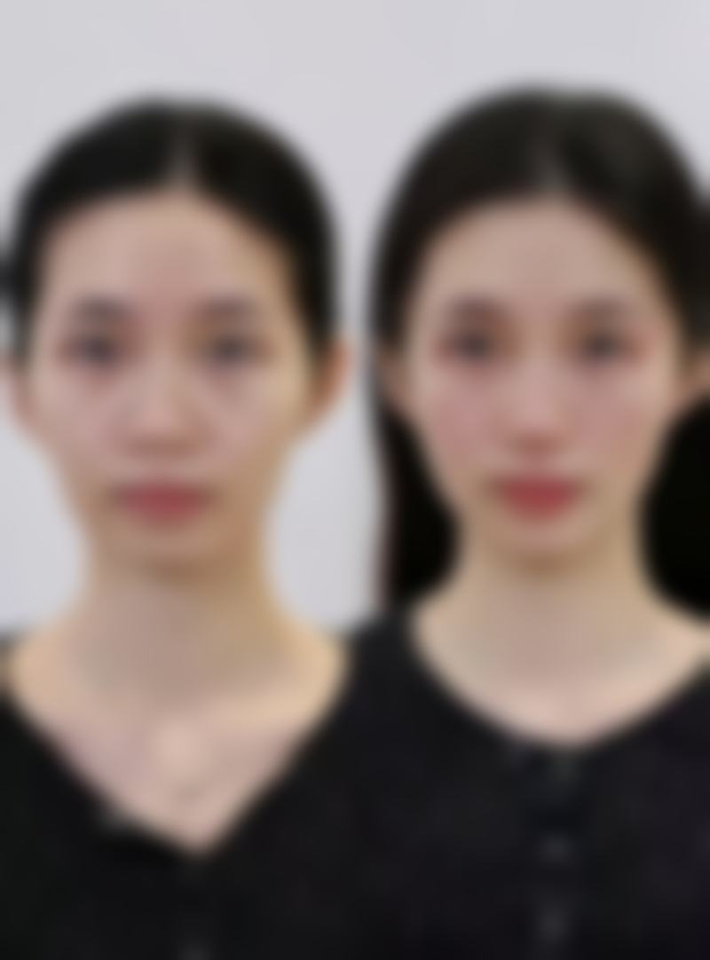 肇庆新妍整形医院医院技术好不好？