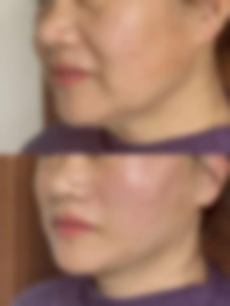 持续观察修复情况