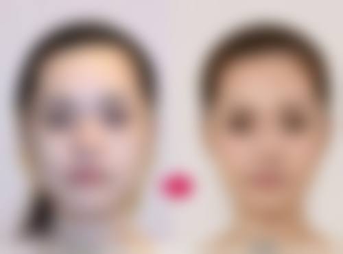 合肥童颜堂整形医疗美容医院医院技术好不好？