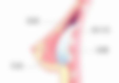 综合判断自己是否为疤痕体质