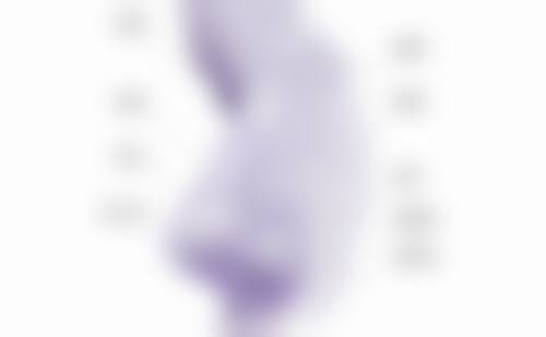 哪些人割双眼皮更好开眼角