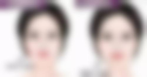 影响去眼袋成效的因素有哪些
