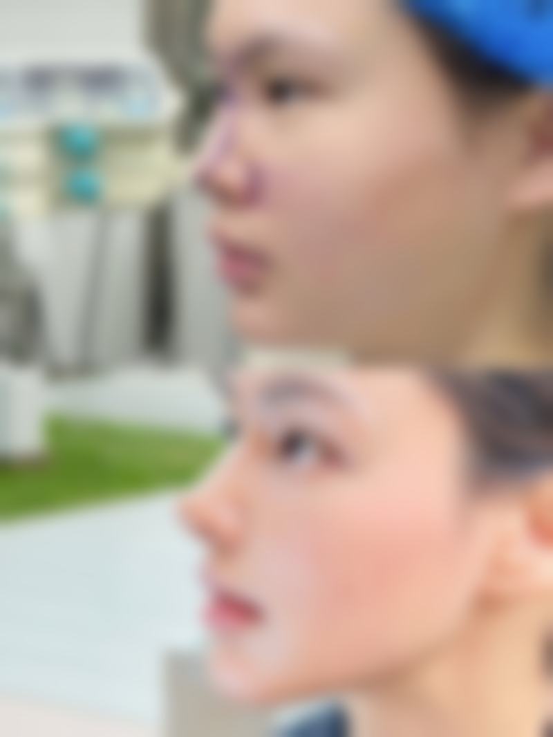 西安春禾整形医院医院技术好不好？