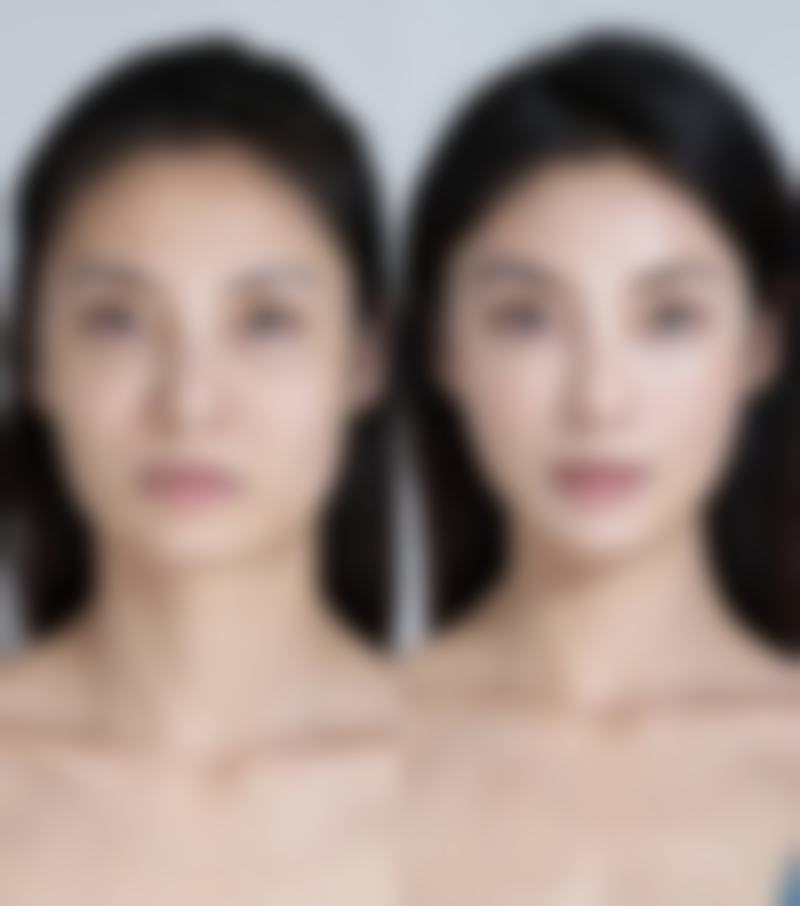 不抽烟对疤痕修复有什么好处