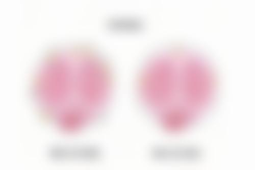 割双眼皮为什么眼屎多？是正常反应、感染、用眼过度还是干眼症在作祟？ 
