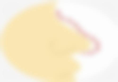 日常护理对去除遗传性眼袋的作用