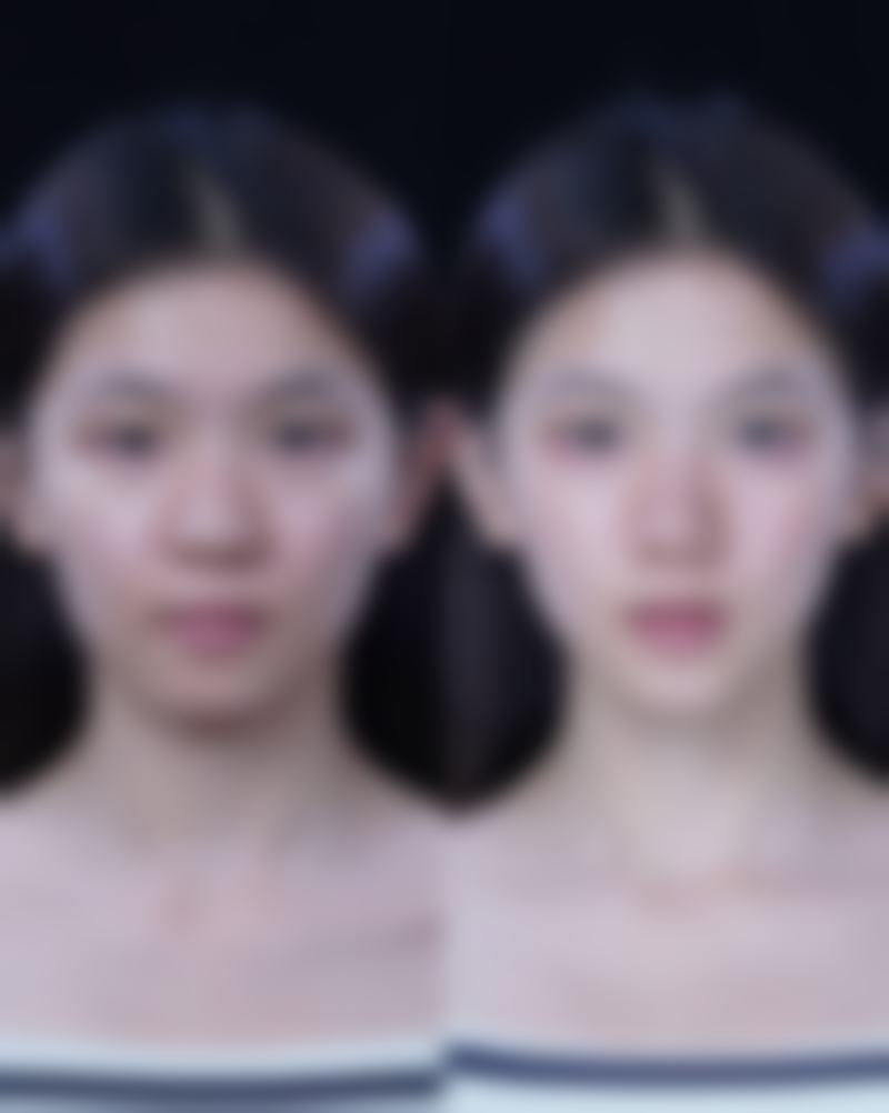 总结——韩国PIND皮肤科怎么样?