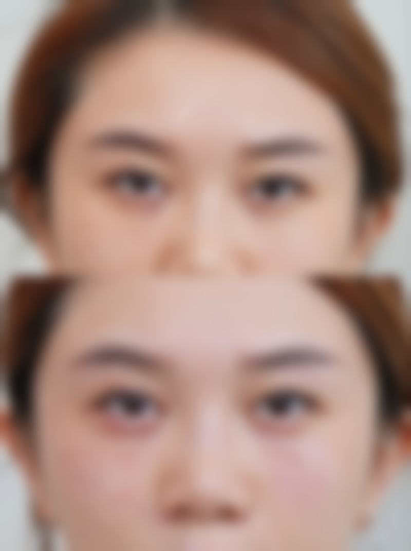 韩国DREAM梦想整形外科医院柳垣在医生挂号预约攻略