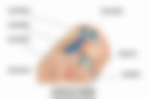 专精医美去眼袋的方法