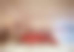 苏州美贝尔美容医院艾维岚340mg聚乳酸淡皱套餐的口碑怎么样?