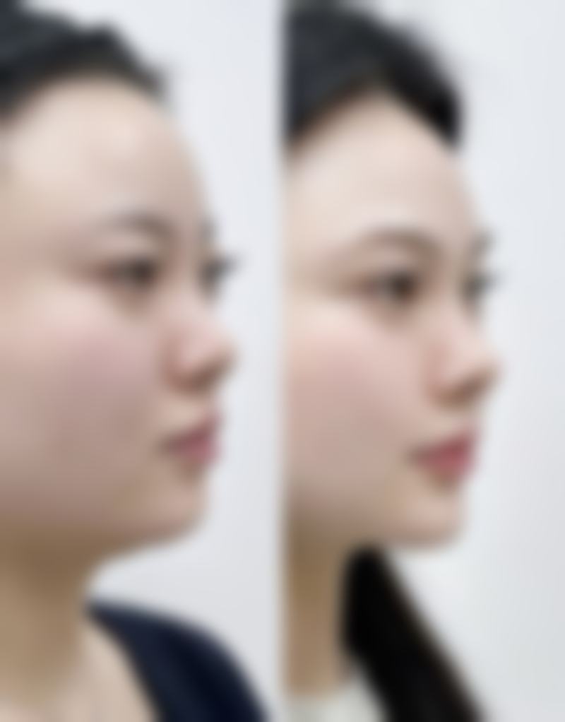 西安康美整形美容中 心医院技术好不好?