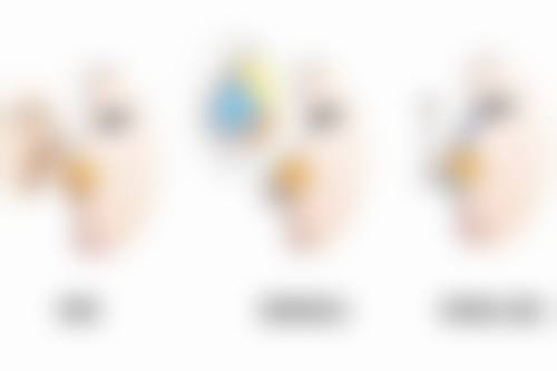 做过手术的疤痕痒是怎么了？或是愈合、增生、炎症等原因及应对办法揭秘