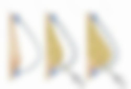 北京美联和谐整形医院于显旭医生技术好不好？