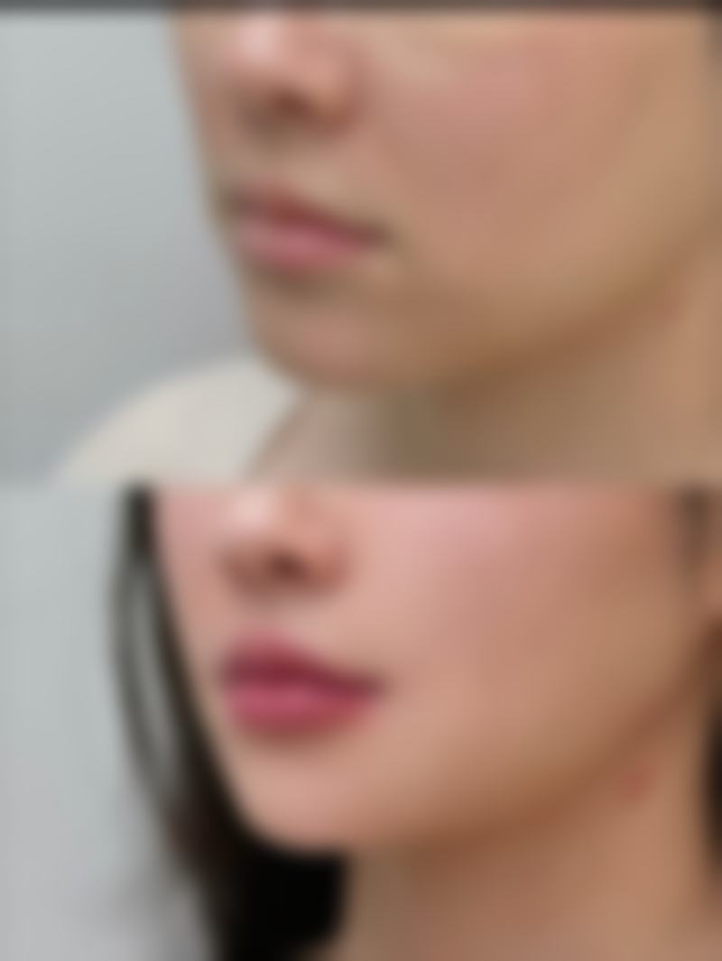 天津菲林格瑞医疗整形美容医院电话号码及预约方法