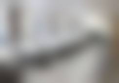 福州台江海峡美容医院厚唇改薄/矫正项目科普：什么样的人适合做厚唇改薄/矫正？