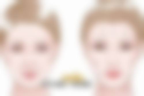 影响除皱成效维持时间的因素