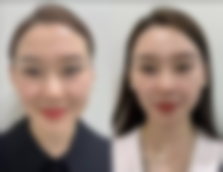 吸脂一般吸多少ml？不同部位、自身状况和医院等级影响吸脂量需综合考量
