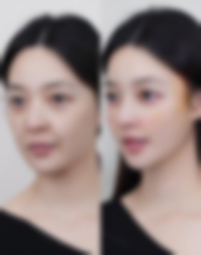遗传因素致使内双眼皮突然变外双