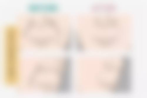 父母都是双眼皮孩子是什么眼皮？可能是双也可能是单，还有后天变双的方法