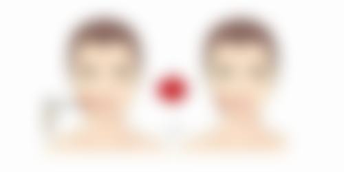 西安市优恩美医疗美容口碑如何?