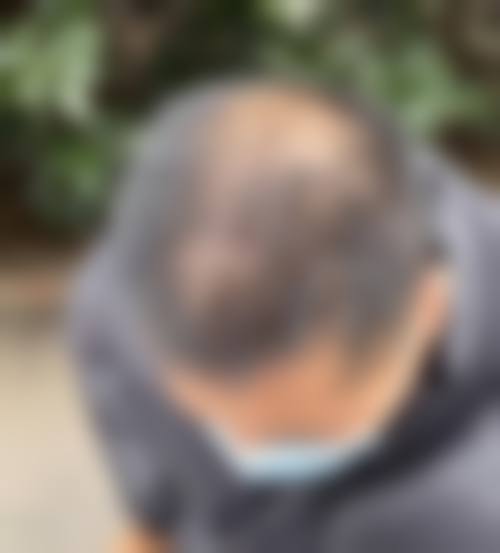 杭州百年植发医生简介