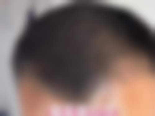 杭州百年植发营业时间
