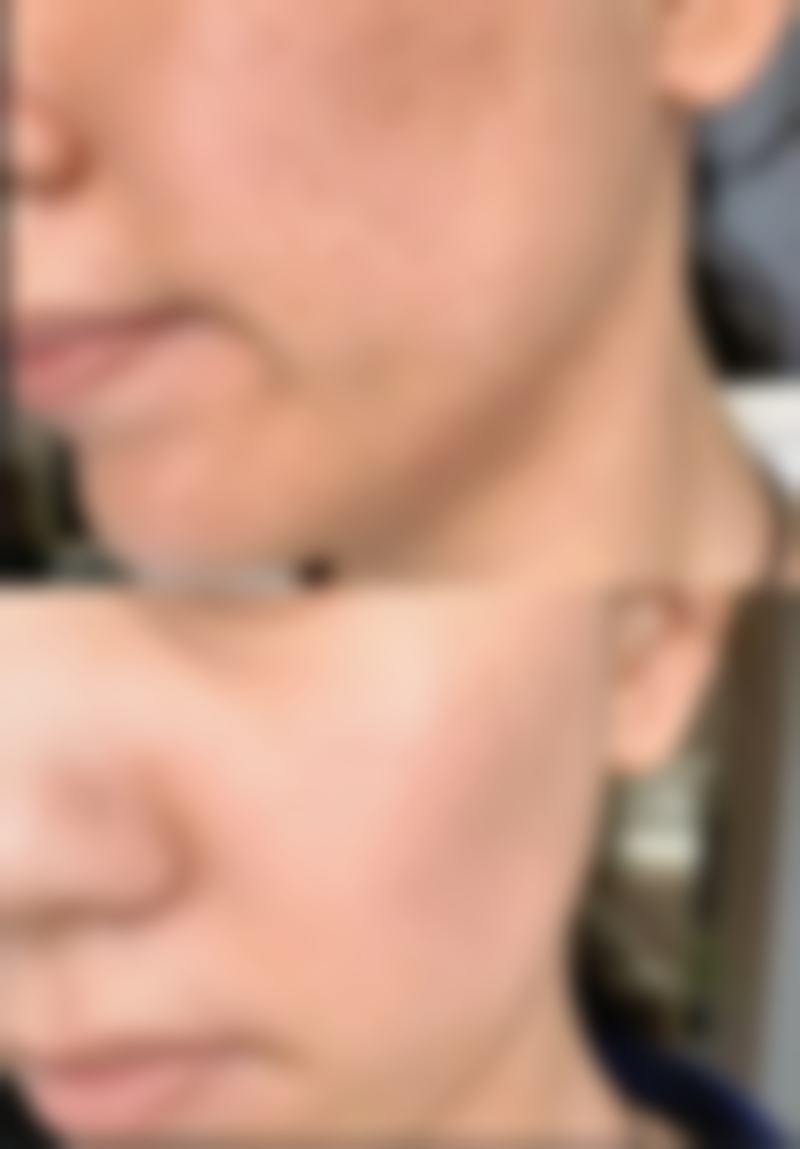 鸡西Dr.W王医生整形医院陈添良医生口碑评价如何?
