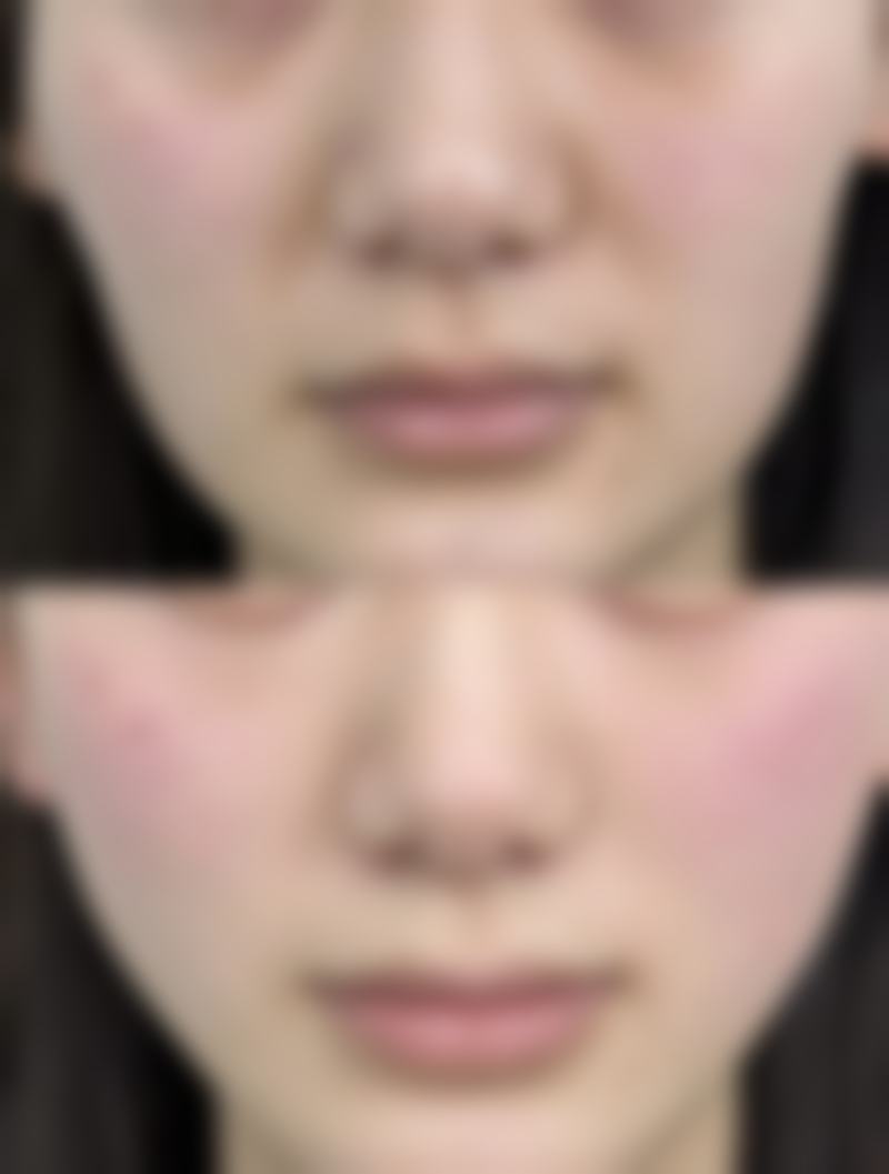 涂抹芦荟胶的正确方法