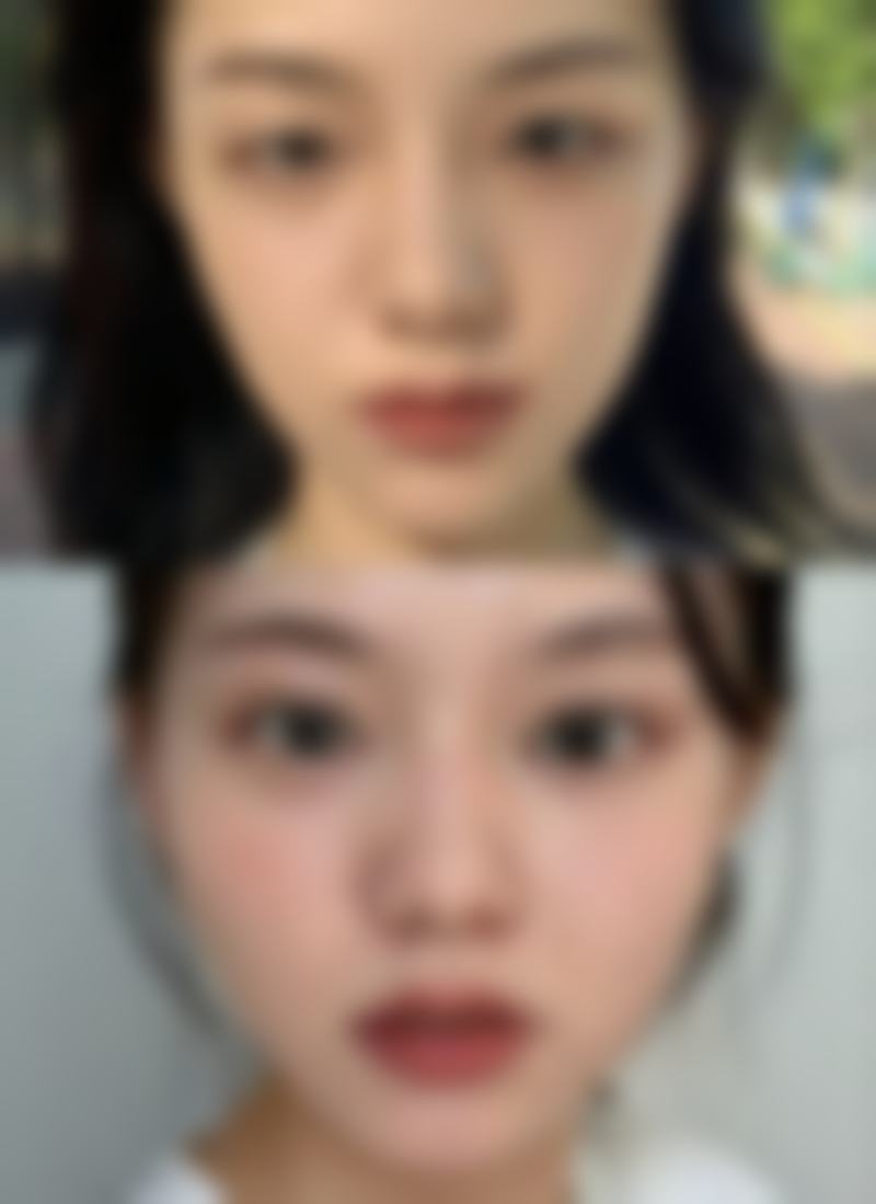 西安市优恩美医疗美容收费标准参考
