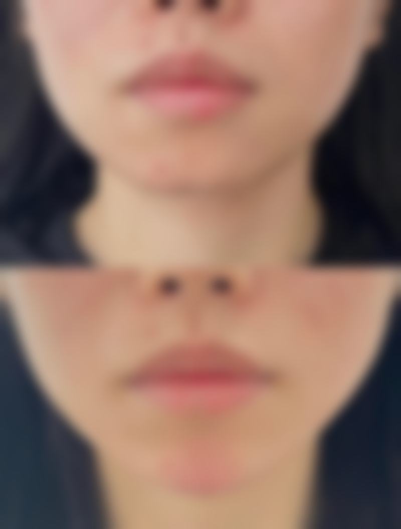 总结——鸡西Dr.W王医生整形医院陈添良医生怎么样?