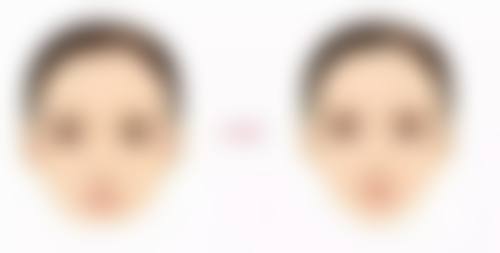 安宁袁刚琼医疗美容诊所医院技术好不好?