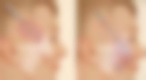 呼伦贝尔董海杰医疗美容诊所医院技术好不好?