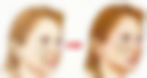 廊坊唯爱可依医疗美容门诊部收费标准参考