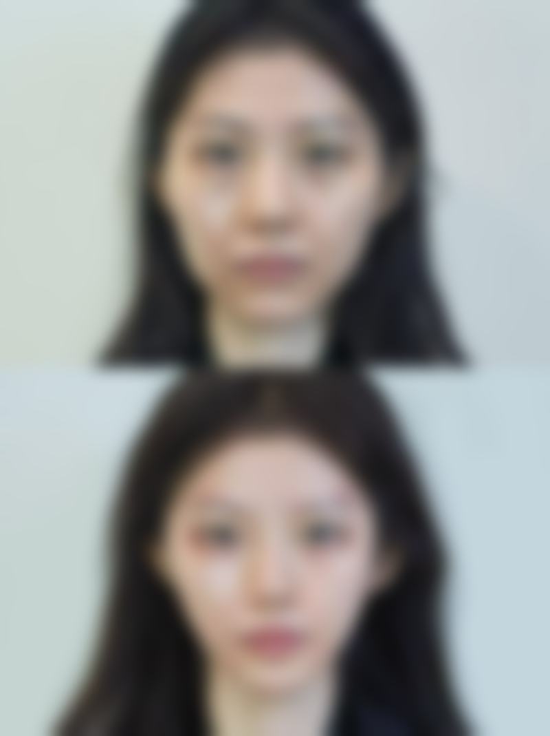 柳州美丽焦点美容整形电话号码及预约方法