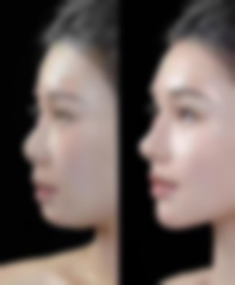 总结——义乌芭莎医疗美容怎么样?