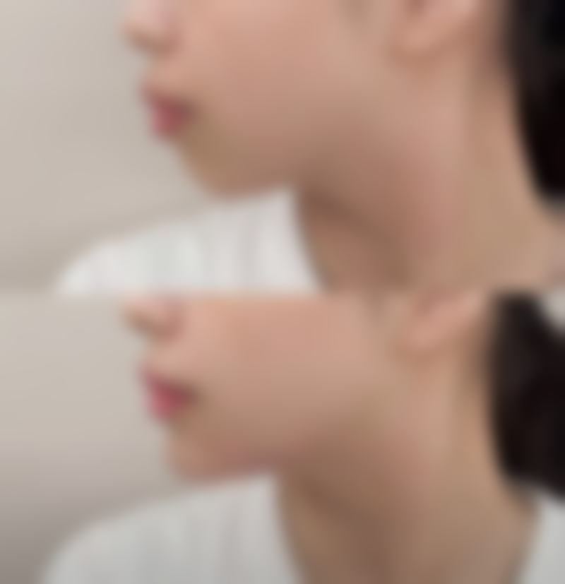 荆门荆悦整形医院口碑如何?