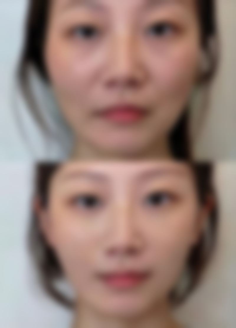 南昌艺和医疗美容门诊部收费标准参考