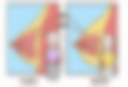 疤痕疙瘩要怎么才能去除？药物、手术、激光等疗法及SRT - 100技术了解下