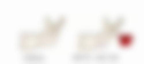 玻尿酸去除眼袋的优点